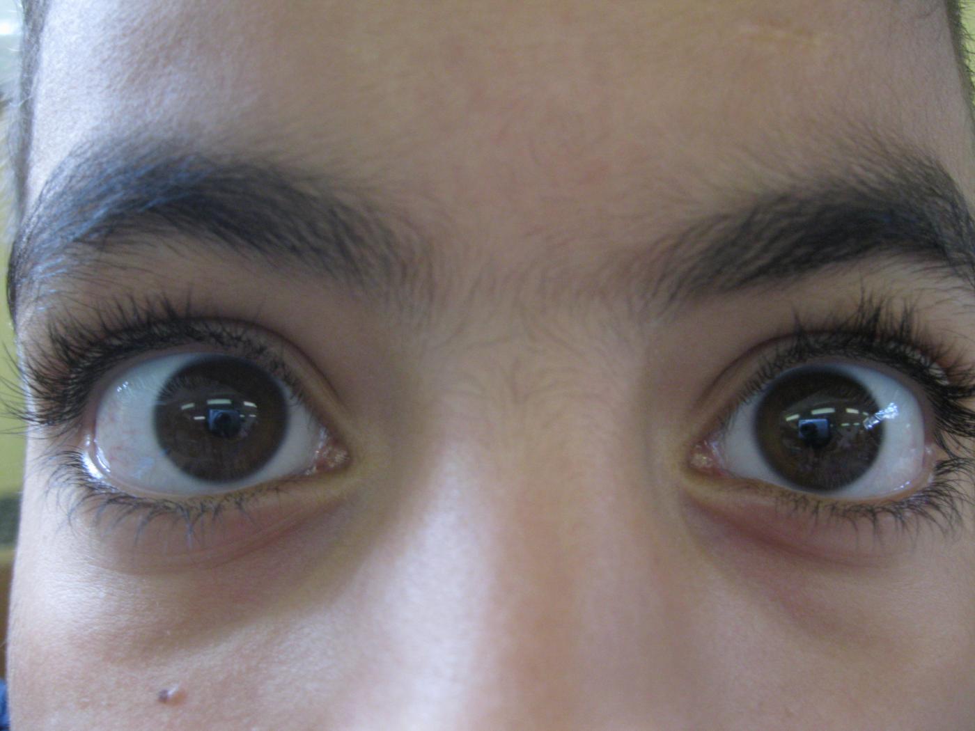 Ö.T. VS Zams 4. Klasse