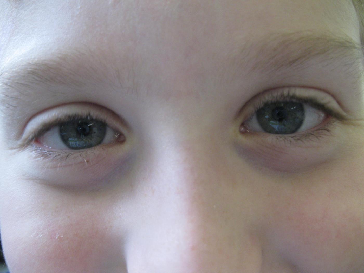 J.B. VS Zams 4. Klasse