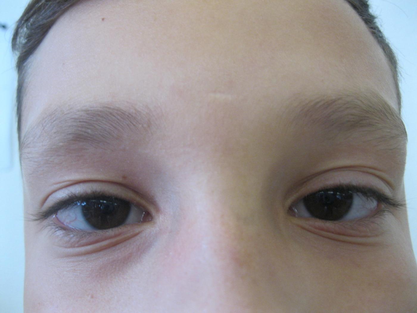 P.V. VS Zams 4. Klasse