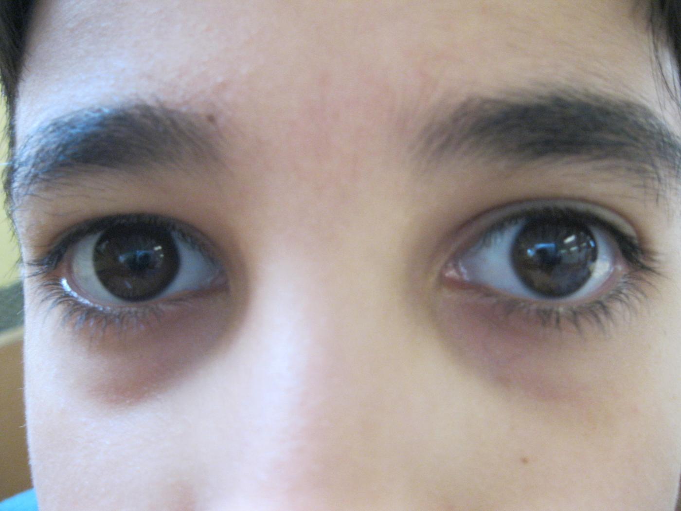 R.C. VS Zams 4. Klasse