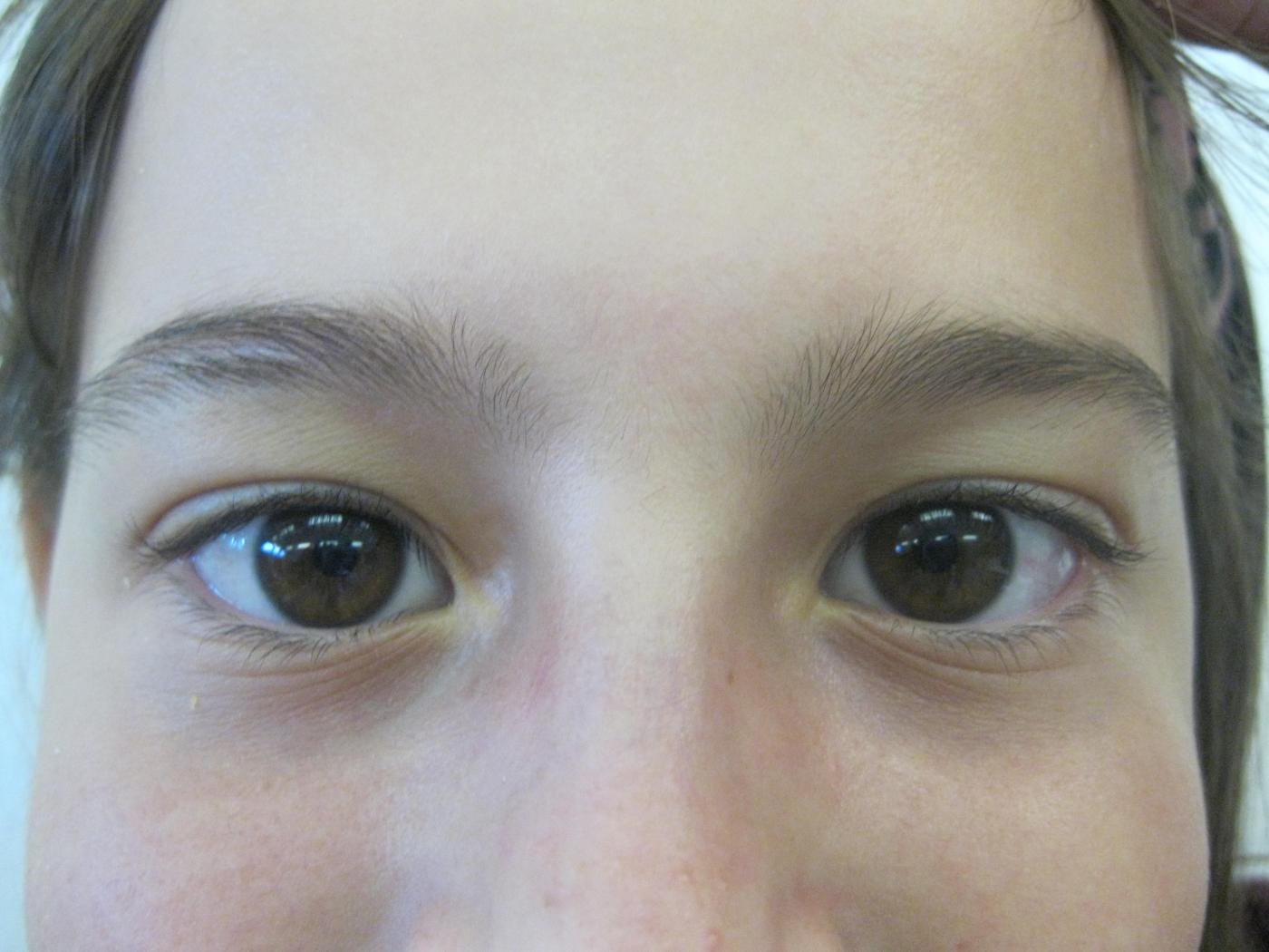 E.W.2 VS Zams 4. Klasse