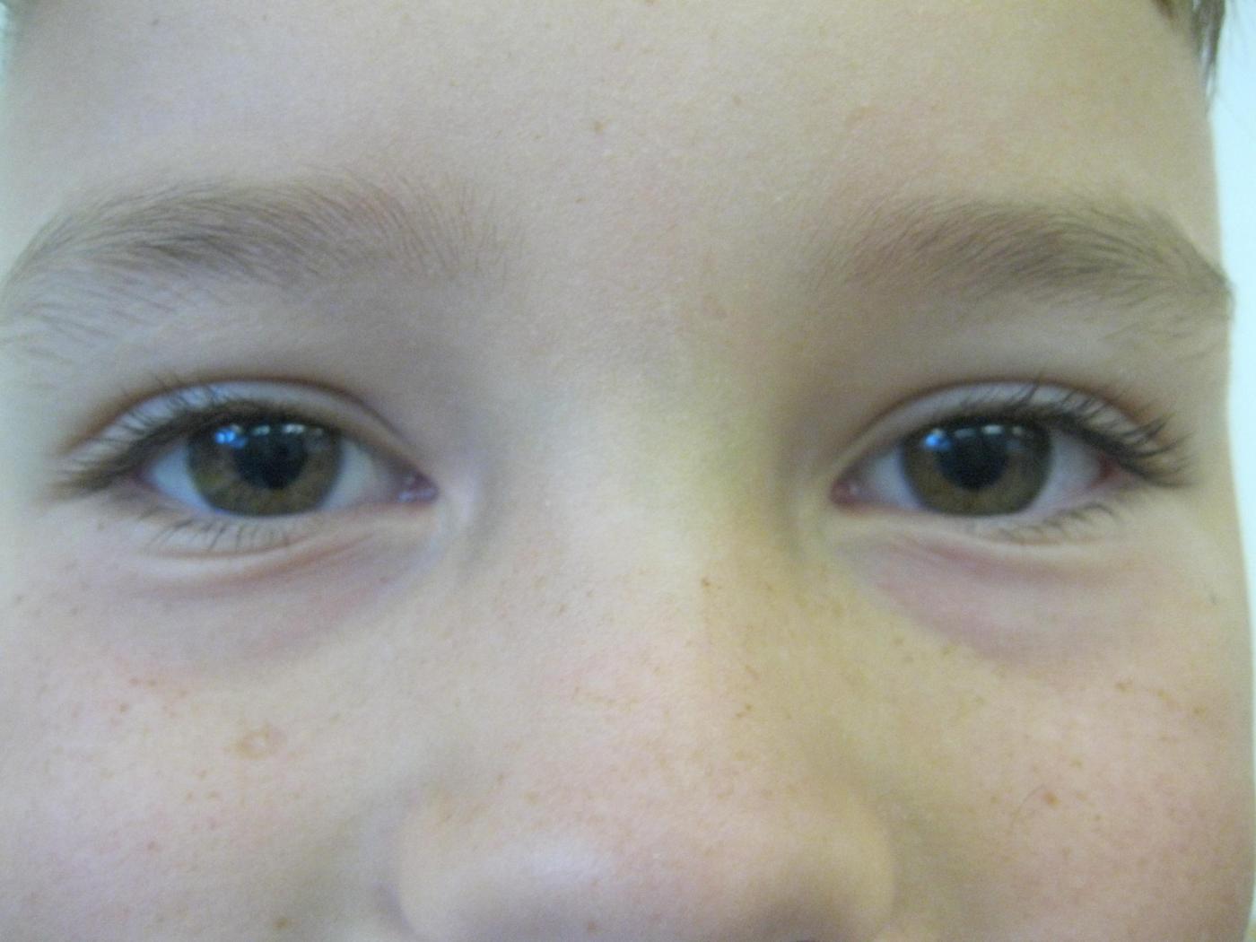 L.W.2 VS Zams 4. Klasse