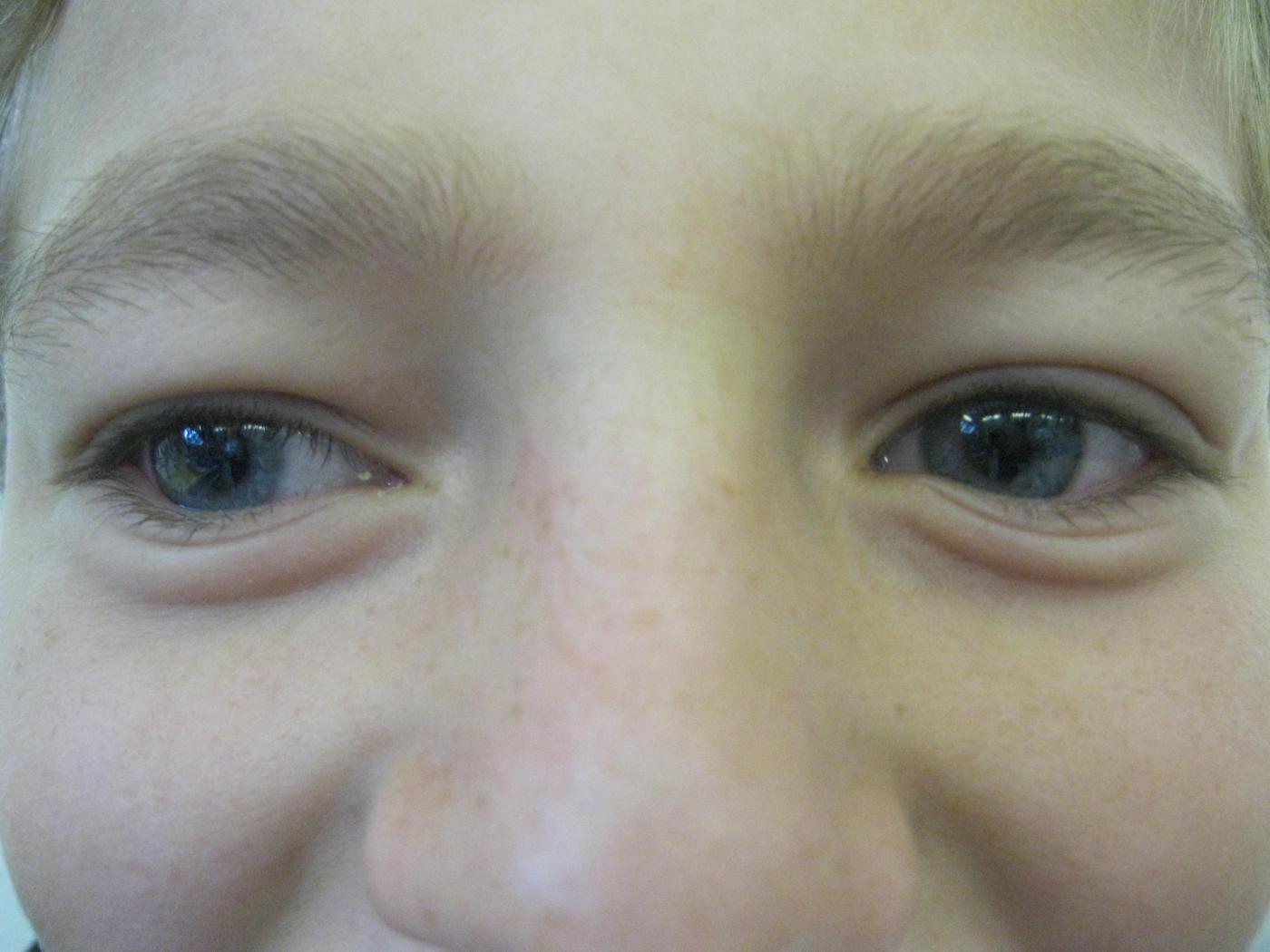 S.Z.2 VS Zams 4. Klasse